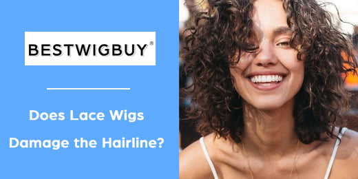 Does Lace Wigs Damage the Hairline?